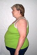 Bea M. "Before" Weight Loss Hypnosis Houston